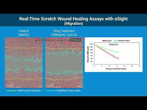 Real-Time Scratch Wound Healing Assays with eSight