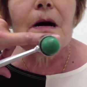 What's the name of this clinical sign and causes ❓ | Medsea