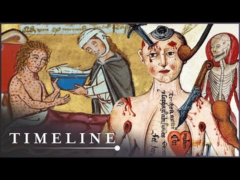 The Most Gruesome Diseases Of The Middle Ages | Medieval Dead | Timeline