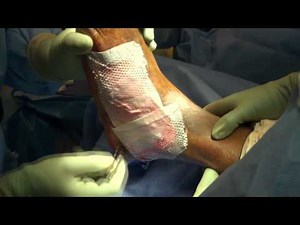 Wound Repair Vol 1 • Video • MEDtube.net
