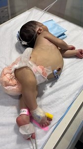 NICU Baby Abdominal Distension & Treatment Disclaimer: This video is for educational and awareness purposes only. Always follow hospital protocol and consult a pediatrician before any newborn care procedure. #NICUDischarge #NewbornCare #BabyObservation #NICUNurse #DischargeProcess #HealthyBaby #NeonatalCare #BabyCareTips #NICULife #HospitalCare #MedicalEducationIndia #HealthcareProfessionals #NewbornHealth | Dr Zaib