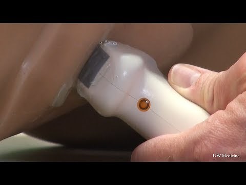 Ultrasound moves kidney stones