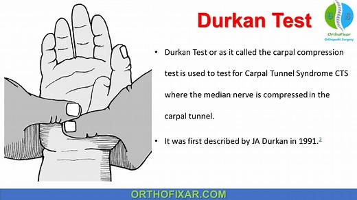 Durkan Test | OrthoFixar 2026