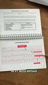 Why the QRS interval is important to paramedics 🚑 #paramedicstudent #studentparamedic #ecg | Pocket Paramedic