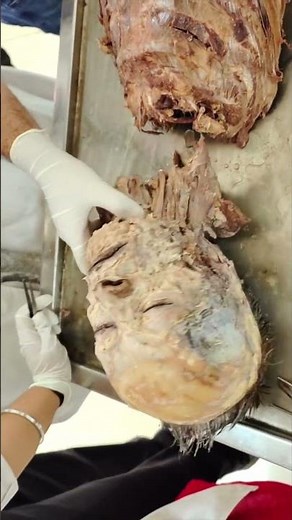 Beginning with dissection of abdomen, Step by step learn how to do dissection of human body #shorts