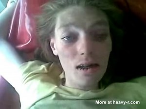 Amphetamine user