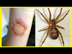 WARNING! This is the most VENOMOUS SPIDER in Brazil.