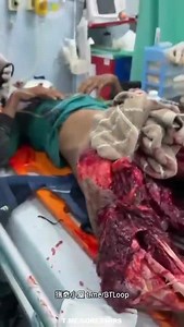 Man Lower Body Shattered