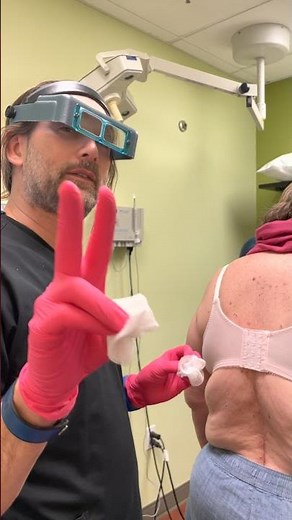 Original Short Video of Open Comedones Treated By Dr. H.L. Greenberg at Las Vegas Dermatology