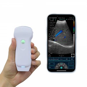 [Hot Item] C10pl 192 Element 3 in 1 Double Head Wireless Mini WiFi Medical Wireless Ultrasound Probe Scanner Portable Ultrasound