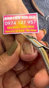 94K views · 1.2K reactions | Bích Liên Hoa Sen on Reels | Facebook