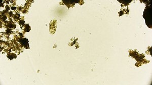 Micro Organism Under Microscope Microorganisms Dark Stock Footage Video (100% Royalty-free) 27746215 | Shutterstock