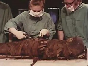 Mummy 1770: Unwrapping mummy from Roman era