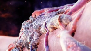 159K views · 3.3K reactions | A recent study documented COMPLETE REMISSION of Stage IV cancers using fenbendazole. Patients with advanced melanoma, breast, and prostate cancer saw their tumors disappear — without chemotherapy. Clinical trials must be launched immediately. | Nicolas Hulscher | Facebook