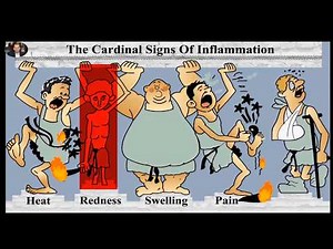 Cardinal signs of inflammation: Prostaglandins and Leukotrienes