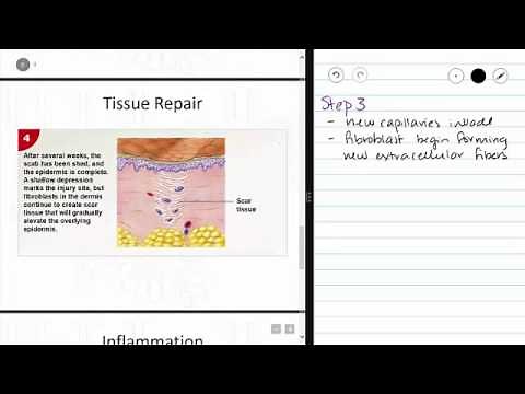Tissues - Tissue Repair