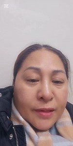 2K views · 234 reactions | Ga hulat ko sa akong eye surgery,pasensya na sakong mata nga murag gi mila2x kay ni atake akong allergy plus maot kaayo basta front camera #viewers #view #fypシ゚viralシ2024fyp #madambisdak | Elsie Naigar Jadman | Facebook