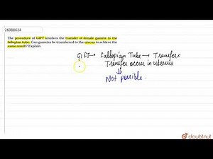 The procedure of GIFT involves the transfer of female gamete to the Fallopian tube.