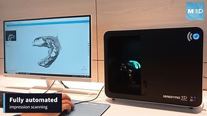Maestro 3D | MDS 500 | Impression Scanning Scanning a dental...