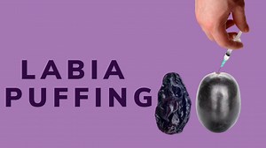 Labia Puffing in Los Angeles, Glendale | Dr. Michael Tahery
