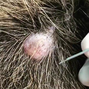 Pimple Popping Videos on Instagram: "Huge cyst on a dog #cyst #cystremoval #pimple #pimplepopper"