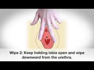 Midstream Clean Catch Urine Sample Collection