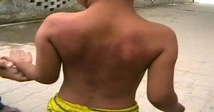 6-Year-Old Allegedly Beaten by Teacher For Not Doing Homework