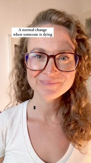 1.6K views · 45 reactions | A normal change when someone is dying. #dyingprocess #deathanddying #deatheducation #deatheducator #endoflife #endoflifeplanning #experience #learn #hospicelife #hospicecare #nurse #doctor #medschool #nursingschool #health #normal #grief #griefsupport #griefjourney #caregiving #normalizedeath #bodychange | Death.Care.Coach | Facebook