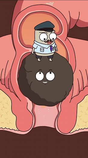 Don’t Push Too Hard: Rectal Prolapse Risks Explained (Funny Guide) . . Rectal prolapse happens when rectal tissue bulges through the anal opening, often from chronic straining, constipation, weak pelvic floor, or prior pelvic surgery. Prevention starts with soft stools: 25–35 g fiber daily, 2–3 L fluids, and regular activity. Avoid prolonged sitting on the toilet and use a footstool to align the anorectal angle. Pelvic floor therapy and biofeedback can retrain defecation dynamics. Treat constipa