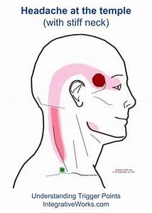 Understanding Trigger Points Headache In The Temple With Neck Tension