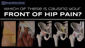 5 Possible Causes For At The Front Of The Hip Stem Cell Blog