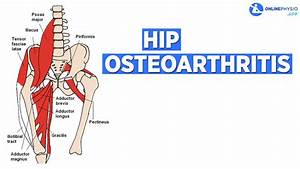 How To Manage Osteoarthritis Of The Hip Onlinephysio App Youtube