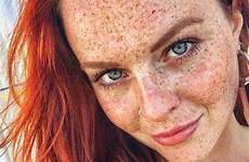 freckles redheads freckle