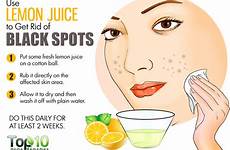 lemon spots face juice dark rid skin remedies marks pimples remove tips spot use clear acne natural reduce pimple care