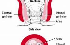 anus incontinence faecal sphincter diagram involuntary