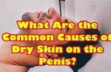 penis skin dry causes common