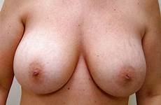 boobs shapes sizes