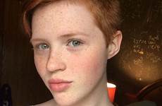redheads freckles
