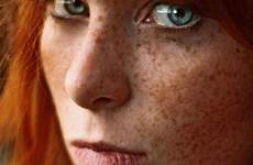 freckles redheads