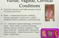 vulvar female conditions disorders vaginal cervical reproductive ppt surgery inflammation infection powerpoint presentation
