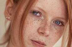 freckles redheads auburn beautyeternal