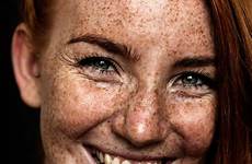 freckled swedish freckles people beautiful redheads red hair girl photographer beauty captured beautifully portrait redhead freckle women woman boredpanda ginger