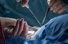 transgender genital surgery men ftm mens medical phalloplasty
