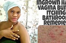 bumps ingrown women shaving waxing hairs itching stop