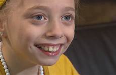 girl disabled old year girls wzzm13 khou triggers globe sweeping invention firstcoastnews michigan