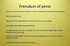 frenuloplasty frenulum penis sensitive foreskin slideshare