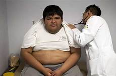 obesity morbid attends threatens overwhelm