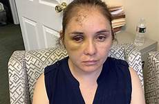 bully beaten unconscious her threatened lawyer passaic racial taunts reported bullies assaulted beronica complained officials ruiz oregonlive pennlive
