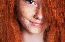 freckles redheads freckled genetic