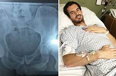 murray hip star accidentally oops revealed